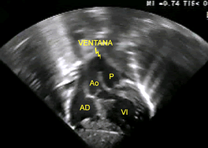 Figura 1